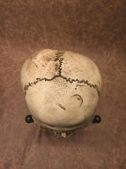Replica - Deformed Human Skull